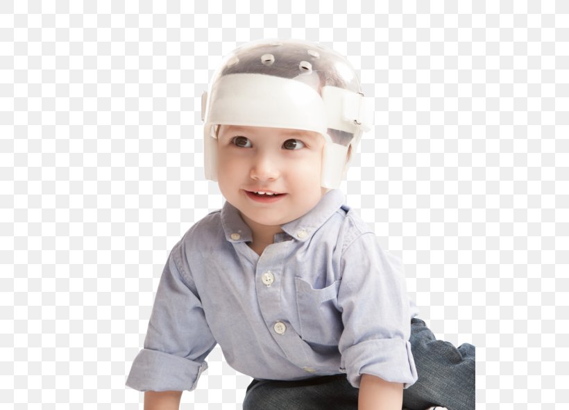 Orthotics Plagiocephaly Skull Pediatrics Child, PNG, 550x590px, Orthotics, Boy, Cap, Child, Decompressive Craniectomy Download Free
