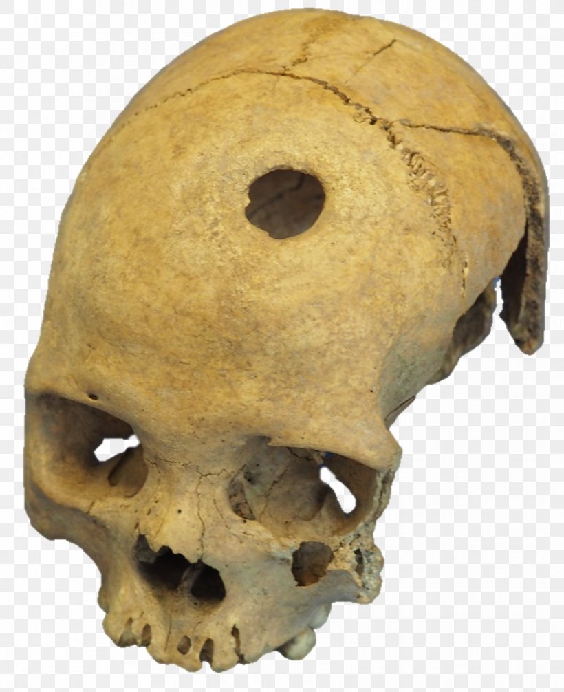 University Of Basel Tautavel Man Snout, PNG, 852x1046px, University Of Basel, Basel, Bone, Head, Image Analysis Download Free