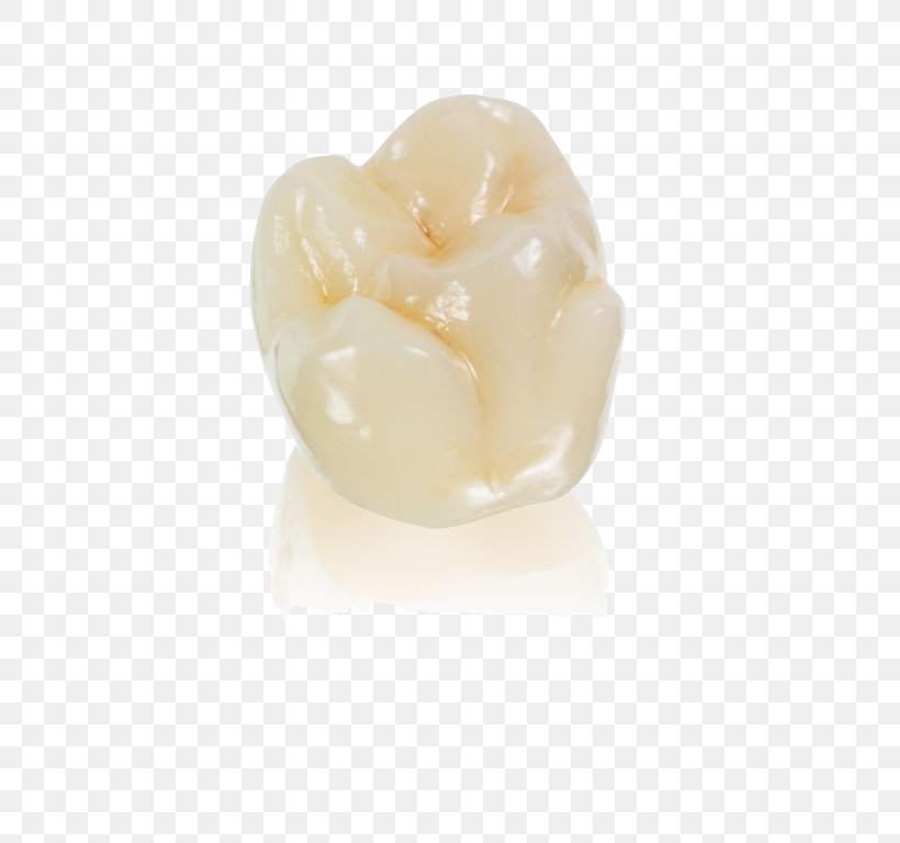 Vitallab, PNG, 576x768px, Vitallab Dental Laboratory, Aesthetics, Bridge, Crown, Dental Implant Download Free