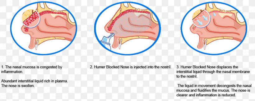 mucous membrane diagram