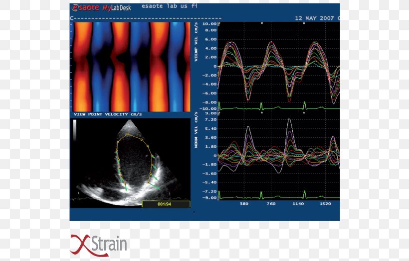 Cardiology Cardiovascular Disease Clinic Colombia Veterinary Medicine, PNG, 700x525px, Cardiology, Cardiovascular Disease, Clinic, Colombia, Facebook Download Free