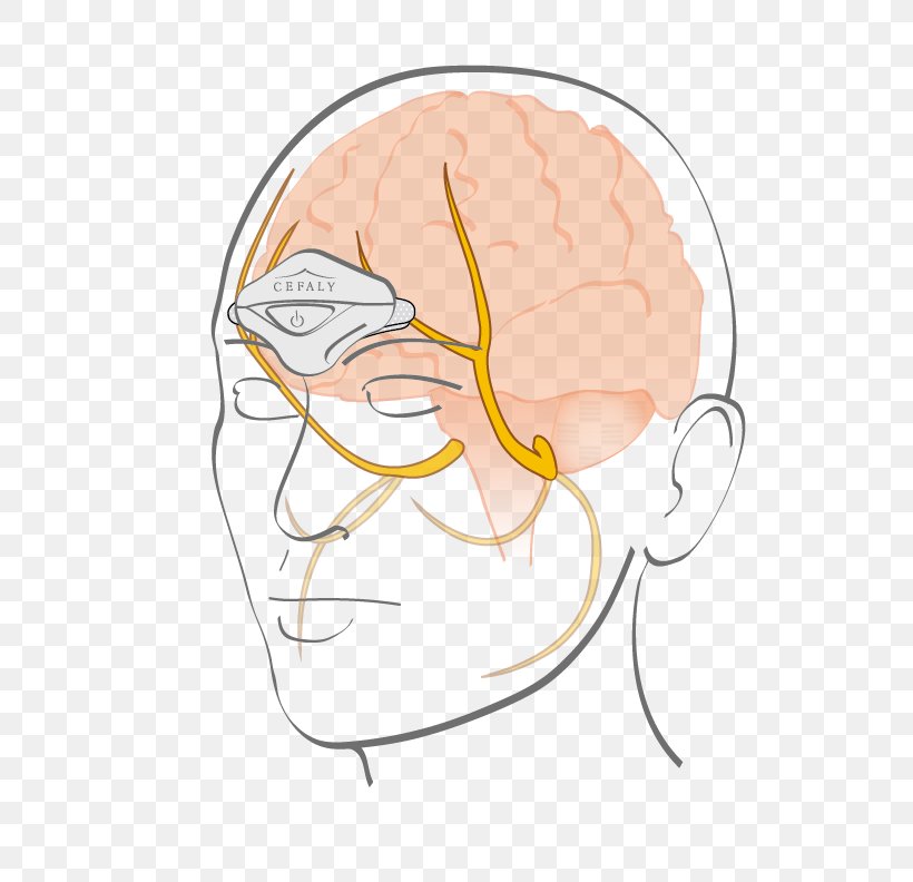 Cefaly Electrode Trigeminal Nerve Migraine Trigeminal Neuralgia, PNG, 612x792px, Watercolor, Cartoon, Flower, Frame, Heart Download Free