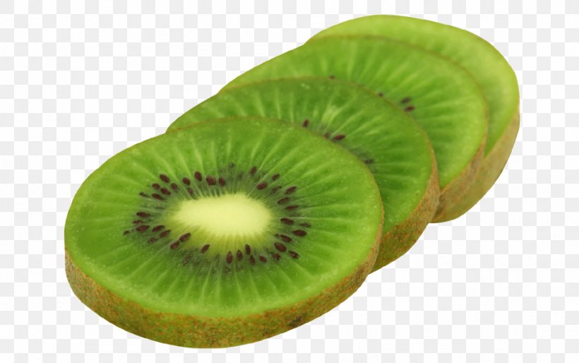 Kiwifruit Clip Art Image, PNG, 957x600px, Kiwifruit, Berries, Food, Fruit, Fruit Salad Download Free