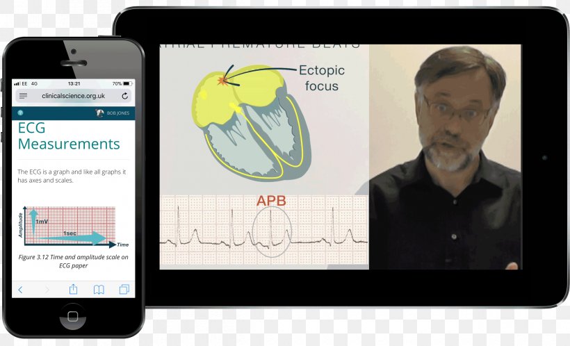Smartphone Electrocardiography Television Show Student IPhone, PNG, 2400x1460px, Smartphone, Acute Disease, Brand, Communication, Communication Device Download Free