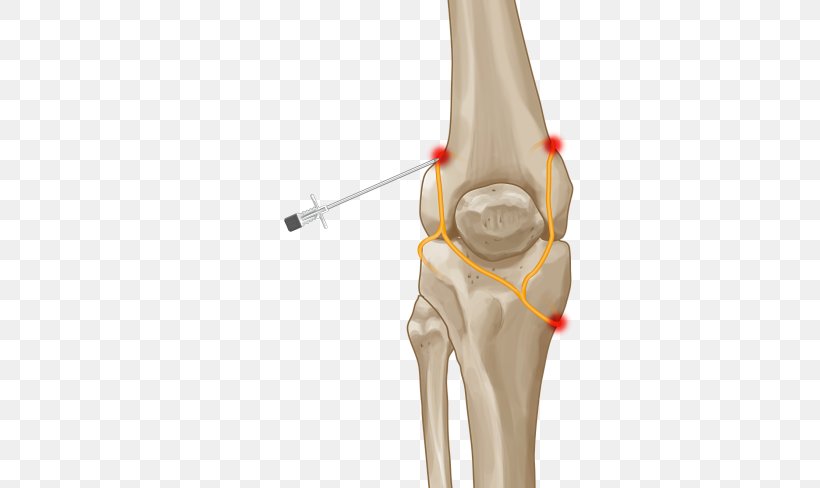 Thumb Knee Pain Joint Nerve, PNG, 520x488px, Thumb, Arm, Bone, Disease, Elbow Download Free