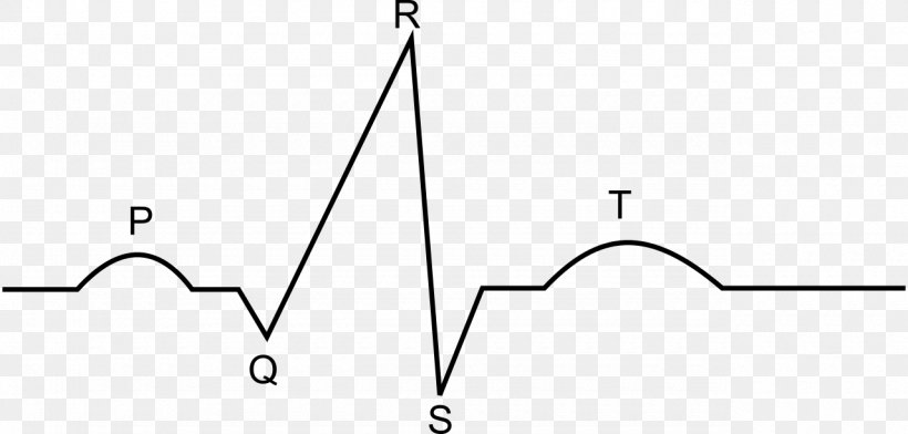 Electrocardiogram Electrocardiography Heart Medicine Drawing, PNG, 1280x613px, Electrocardiogram, Acute Myocardial Infarction, Area, Black And White, Cardiac Cycle Download Free