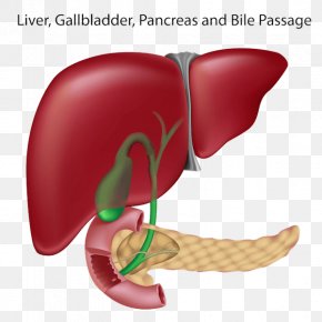 Liver Metastasis Bile Duct Gallbladder Hepatocellular Carcinoma, PNG ...