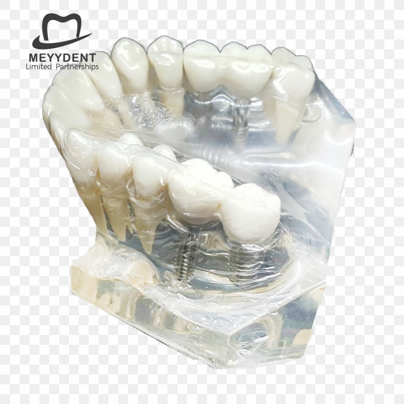 Human Tooth Dental Laboratory หจก.เมย์เด้นท์ Jaw, PNG, 1500x1500px, Human Tooth, Dental Laboratory, Dentistry, Email, Gmail Download Free