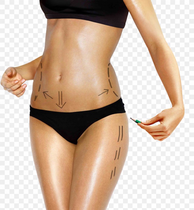 Body Contouring Liposuction Human Body Belt Lipectomy Surgery, PNG, 2544x2756px, Watercolor, Cartoon, Flower, Frame, Heart Download Free