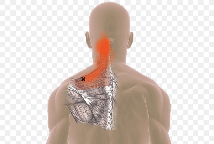 Neck Pain Myofascial Trigger Point Trapezius Muscle Spasm, PNG, 533x552px, Watercolor, Cartoon, Flower, Frame, Heart Download Free
