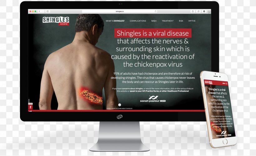 Shingles Therapy Zoster Vaccine MedMedia Limited Information, PNG, 1103x675px, Shingles, Brand, Complication, Display Advertising, Display Device Download Free