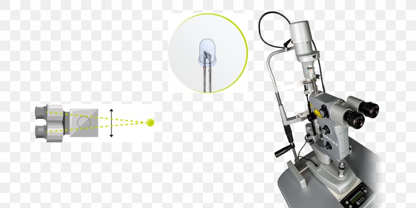 Nd:YAG Laser Capsulotomy Slit Lamp Iridectomy Photodisruption, PNG, 1500x750px, Ndyag Laser, Auto Part, Capsulotomy, Career, Hardware Download Free
