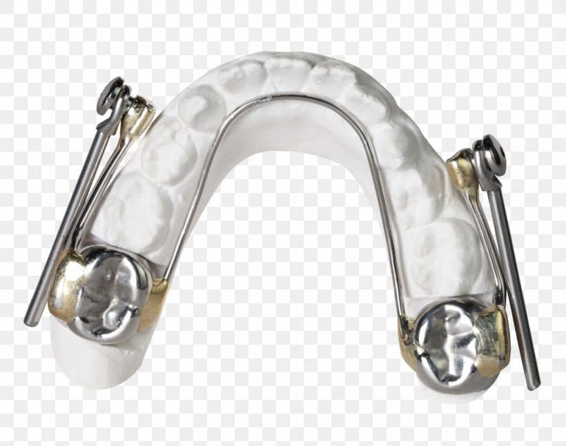 Orthodontics Bionator Retainer Orthodontic Technology, PNG, 1024x808px, Orthodontics, Auto Part, Bionator, David Gergen, Hardware Download Free