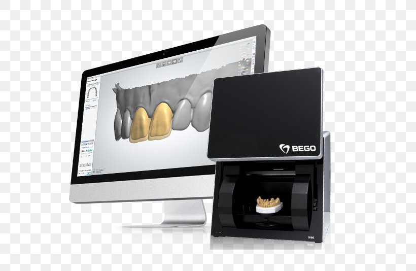 CAD/CAM Dentistry Regenerative Dentistry Dental Laboratory Computer-aided Design, PNG, 800x534px, Cadcam Dentistry, Articulator, Computeraided Design, Cosmetic Dentistry, Dental Implant Download Free
