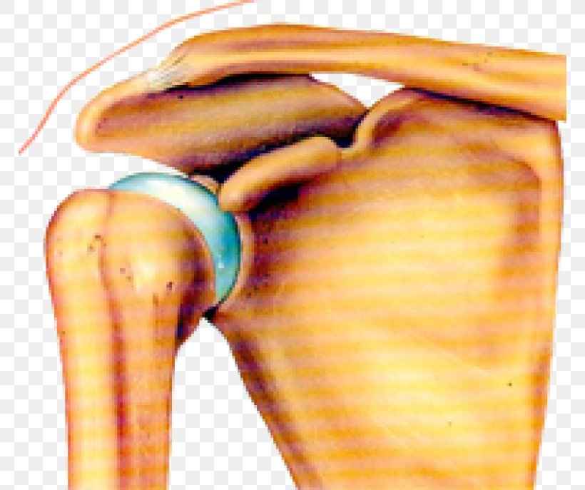 Joint Dislocation Shoulder Bone Arm, PNG, 768x687px, Joint, Arm, Bone, Cancer, Clavicle Download Free