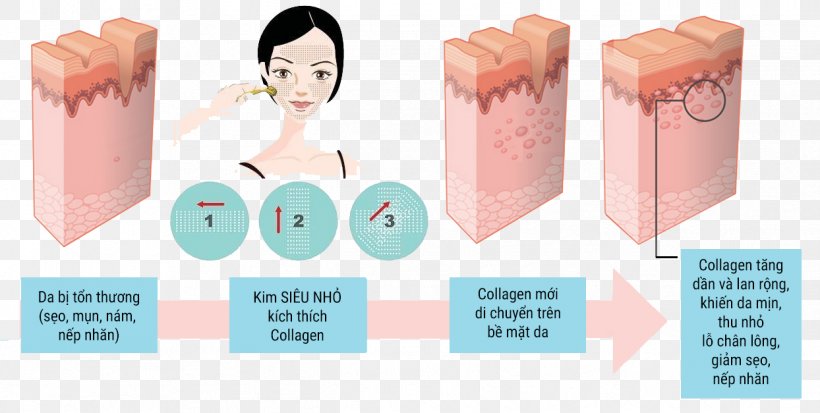 Collagen Induction Therapy Dermis Scar Wrinkle, PNG, 1244x627px, Watercolor, Cartoon, Flower, Frame, Heart Download Free