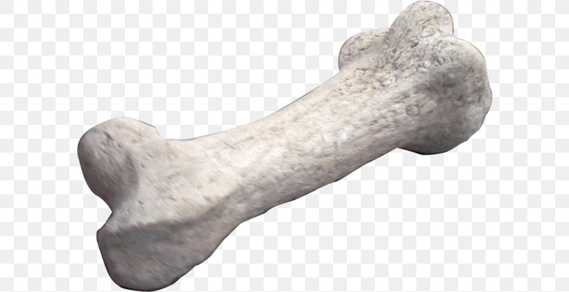 Apatosaurus Dinosaur Bones Fossil, PNG, 600x421px, Apatosaurus, Animal, Bone, Bone Cancer, Bone Fracture Download Free