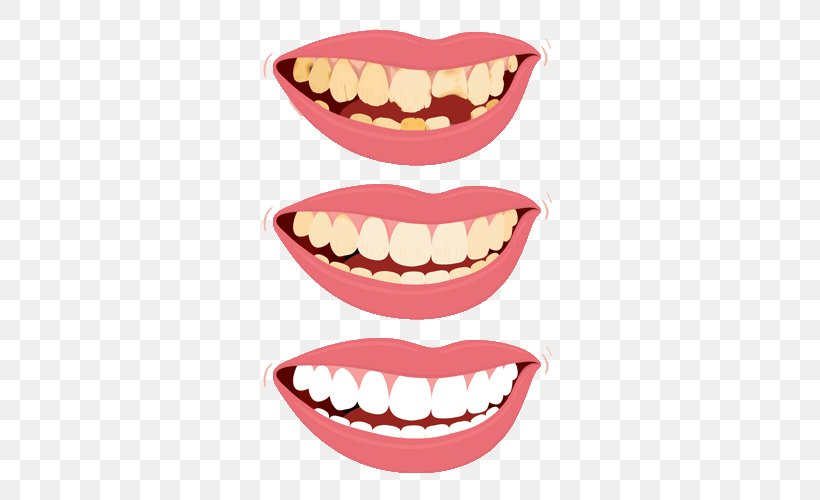 Human Tooth Food Tooth Decay Clip Art, PNG, 500x500px, Tooth, Dentist, Dentition, Drawing, Food Download Free