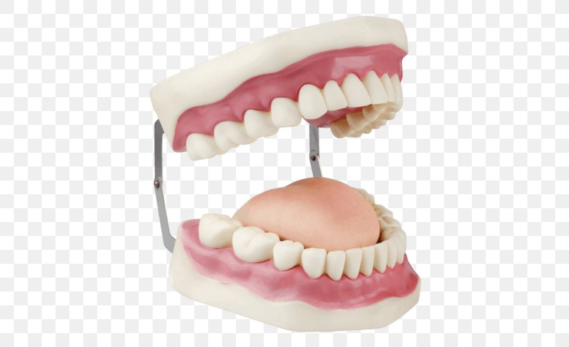 Dentures Dentistry Dental Instruments Human Tooth Dental Implant, PNG, 500x500px, Dentures, Dental College, Dental Implant, Dental Instruments, Dental Laboratory Download Free