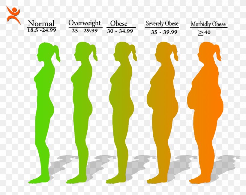 Obesity Body Mass Index Health Disease Weight, PNG, 1000x792px, Obesity, Adolphe Quetelet, Antiobesity Medication, Area, Body Mass Index Download Free