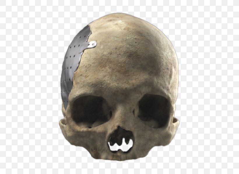 Cranioplasty Poly Skull Snout Skeleton, PNG, 600x599px, Cranioplasty, Bone, Business, Computer Software, Engineer Download Free