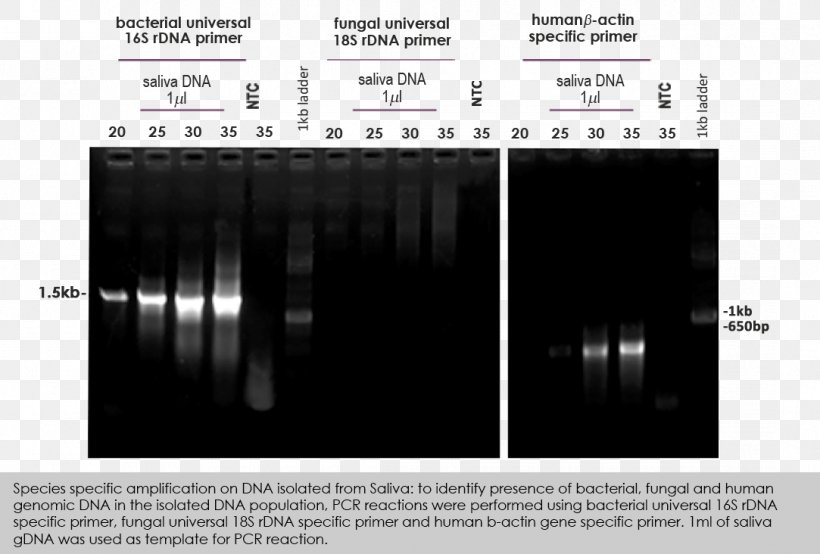 Polyacrylamide Gel Electrophoresis Polymerase Chain Reaction Denaturation, PNG, 1083x732px, Polyacrylamide Gel Electrophoresis, Agarose, Agarose Gel Electrophoresis, Automotive Tire, Black And White Download Free