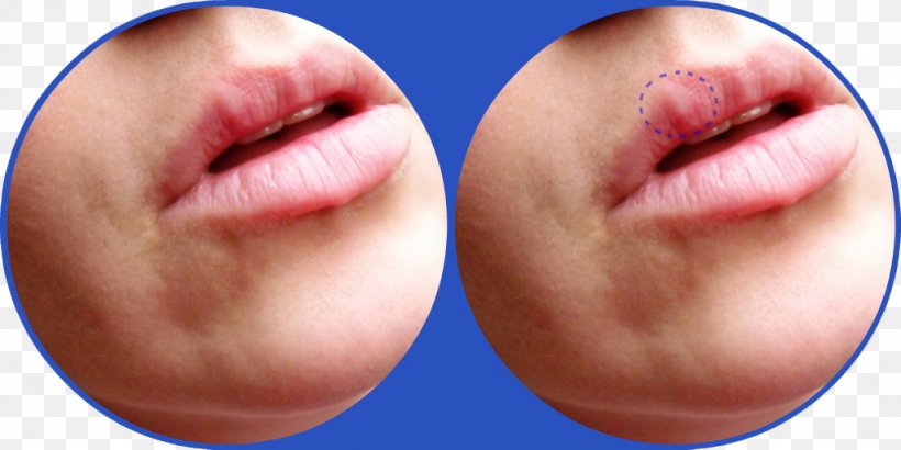 Chin Face Cheek Forehead Lip, PNG, 1024x512px, Chin, Cheek, Close Up, Ear, Eyebrow Download Free