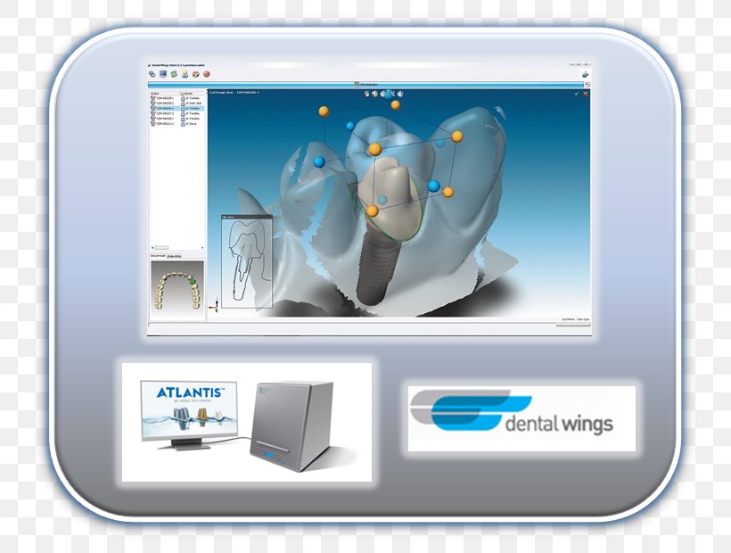 CAD/CAM Dentistry Tooth Crown, PNG, 775x620px, Cadcam Dentistry, Brand, Crown, Dental Implant, Dental Technician Download Free