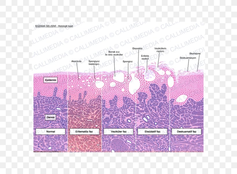 Histology Keratinocyte Dermatitis Corte Histológico Acanthosis, PNG, 600x600px, Histology, Anatomy, Biology, Brand, Cell Download Free