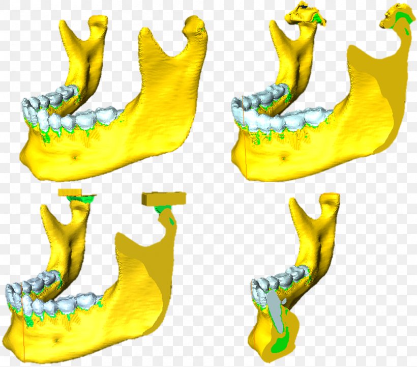 Shoe Product Design Jaw Font, PNG, 1038x913px, Shoe, Animal Figure, Jaw, Yellow Download Free
