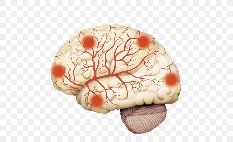 Disease Arteriosclerosis Cerebrum Intracranial Aneurysm Brain, PNG, 500x500px, Watercolor, Cartoon, Flower, Frame, Heart Download Free