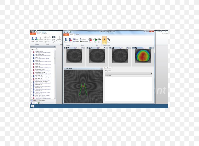 Corneal Topography Surveyor Computer Software Orthokeratology, PNG, 600x600px, Topography, Brand, Computer Software, Contact Lenses, Cornea Download Free