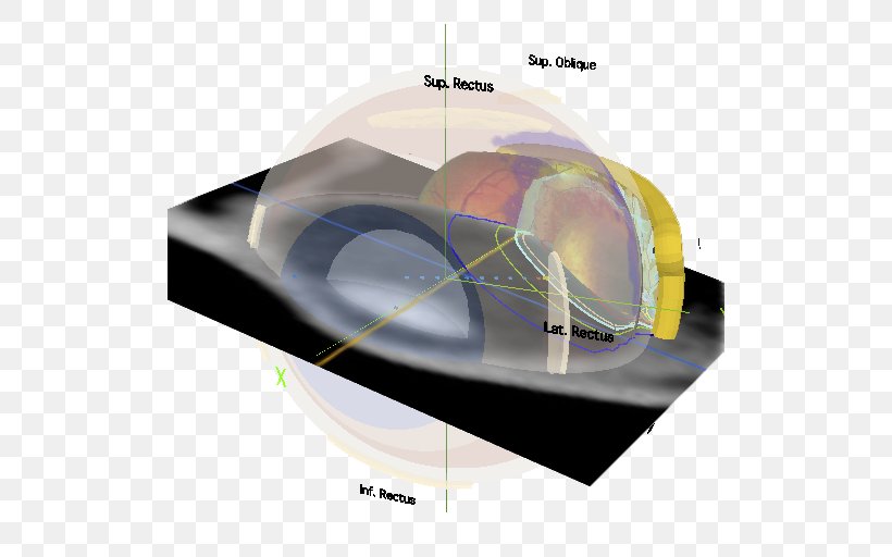 Eye Physics LLC Angle, PNG, 512x512px, Eye, Computer Software, Dental Plaque, Limited Liability Company, Physics Download Free