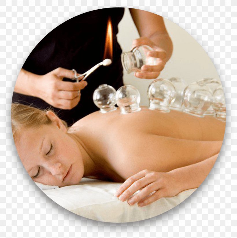 Cupping Therapy Massage Traditional Chinese Medicine Acupuncture, PNG, 869x872px, Cupping Therapy, Ache, Acupressure, Acupuncture, Alternative Health Services Download Free