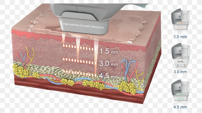 High-intensity Focused Ultrasound Rhytidectomy Skin Lux Medical Aesthetics Clinic, PNG, 1600x900px, Highintensity Focused Ultrasound, Body Contouring, Box, Carton, Clinic Download Free