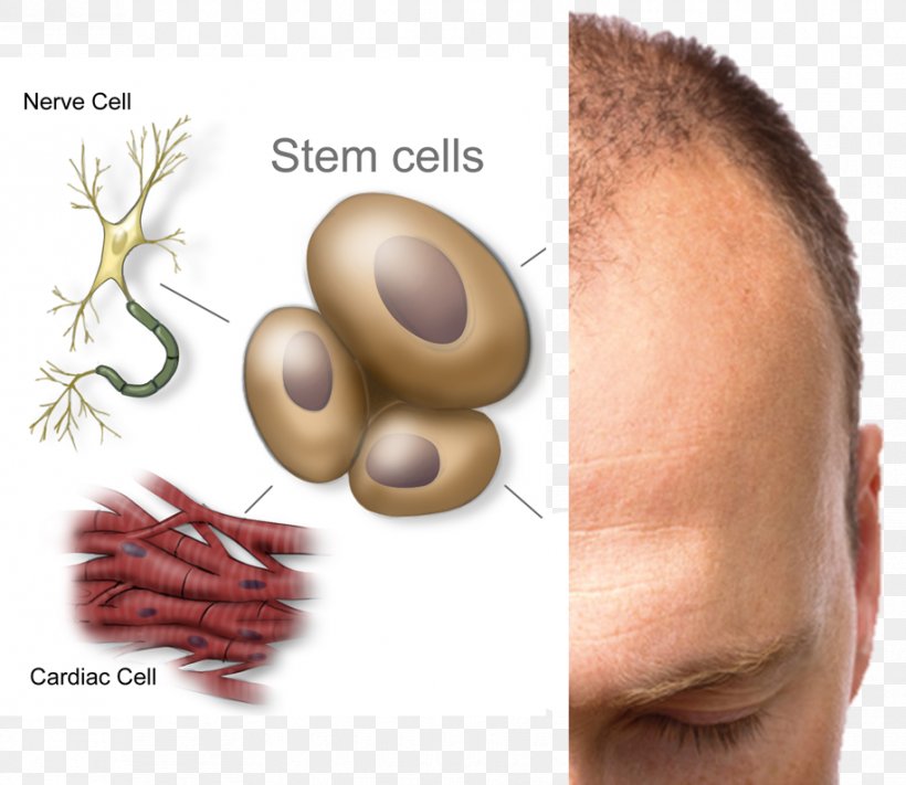Stem Cell Stem-cell Therapy Disease Cord Blood Bank, PNG, 916x795px, Stem Cell, Blood, Blood Cell, Cell, Cell Therapy Download Free