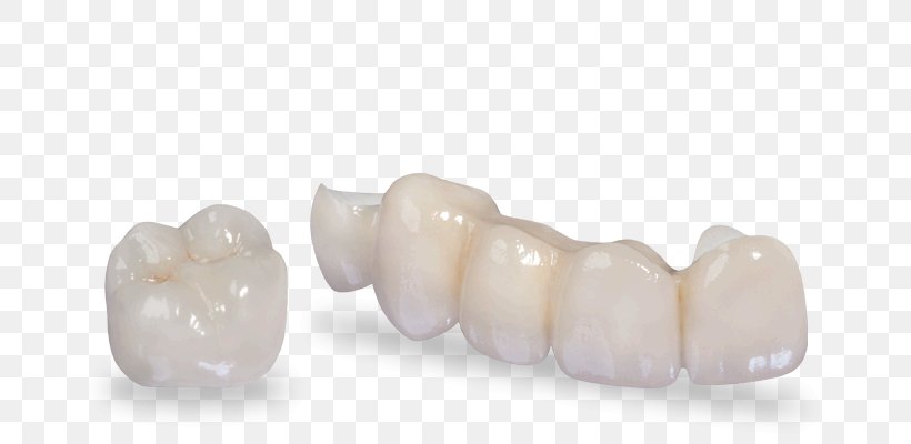 Crown Zirconium Dioxide Dentistry Tooth, PNG, 675x400px, Crown, Aesthetics, Body Jewelry, Cubic Zirconia, Dental Implant Download Free