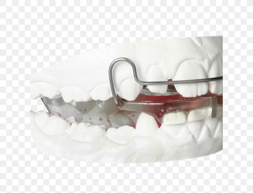 Gergen's Orthodontic Lab Orthodontics Orthodontic Technology Jaw Gergens Orthodontic Lab, PNG, 625x625px, Orthodontics, Arizona, Gergens Orthodontic Lab, Home Appliance, Jaw Download Free