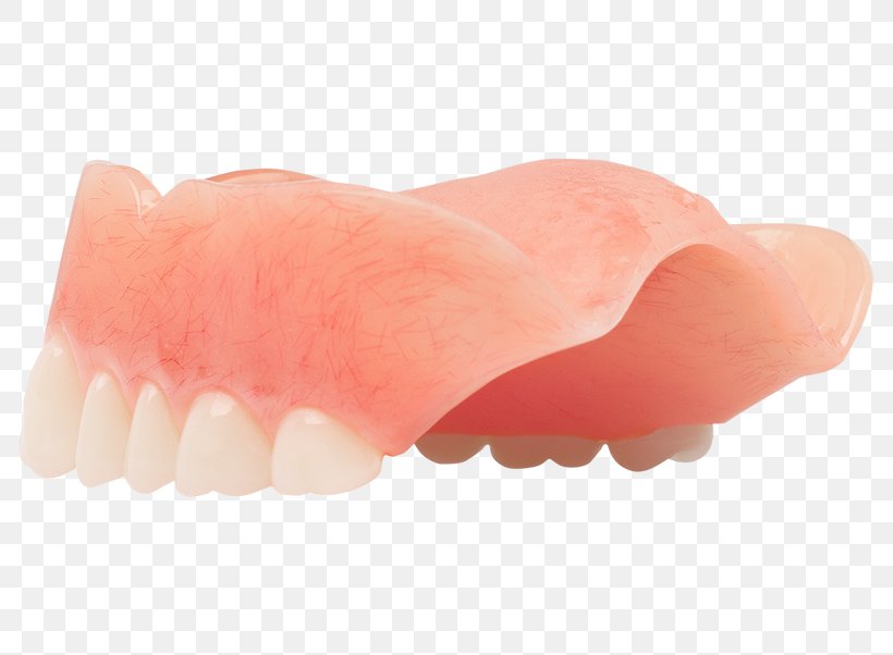 Dentures Human Tooth Dentistry Aspen Dental, PNG, 800x602px, Dentures, Aspen Dental, Classic, Dentistry, Finger Download Free