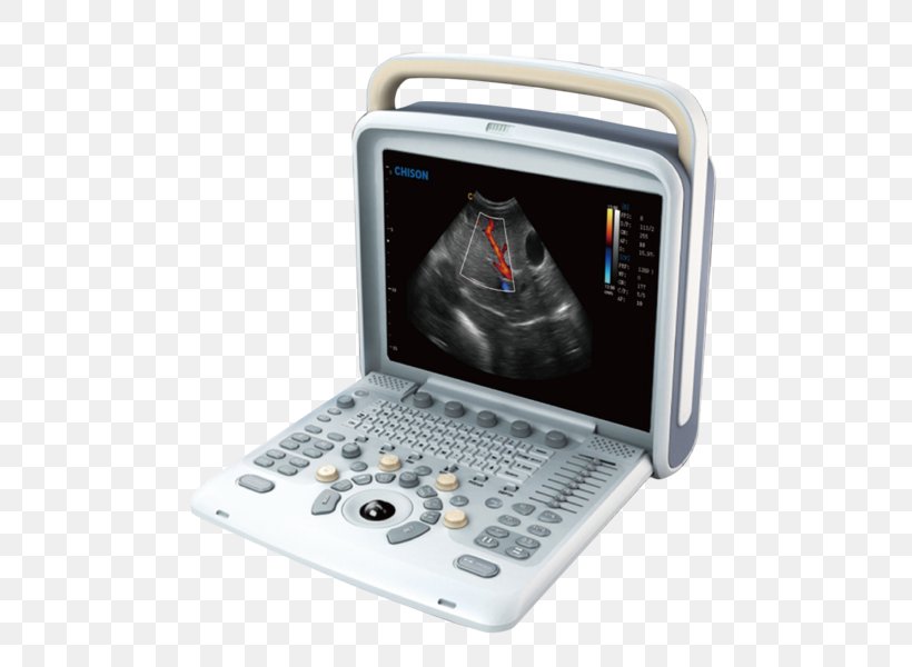 Ultrasonography Portable Ultrasound Doppler Echocardiography Medical Equipment, PNG, 551x600px, Ultrasonography, Computed Tomography, Doppler Echocardiography, Electronics, Ge Healthcare Download Free