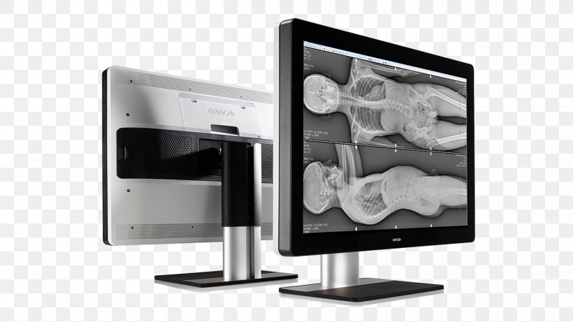 Computer Monitors Graphics Cards & Video Adapters Display Device Flat Panel Display Output Device, PNG, 1260x709px, Computer Monitors, Barco, Brightness, Computer, Computer Industry Download Free