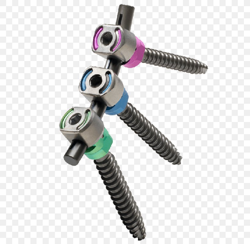 Vertebral Column Lumbar Vertebrae Implant Scoliosis Surgery, PNG, 800x800px, Vertebral Column, Arthrodesis, Camera Accessory, Discectomy, Hardware Download Free