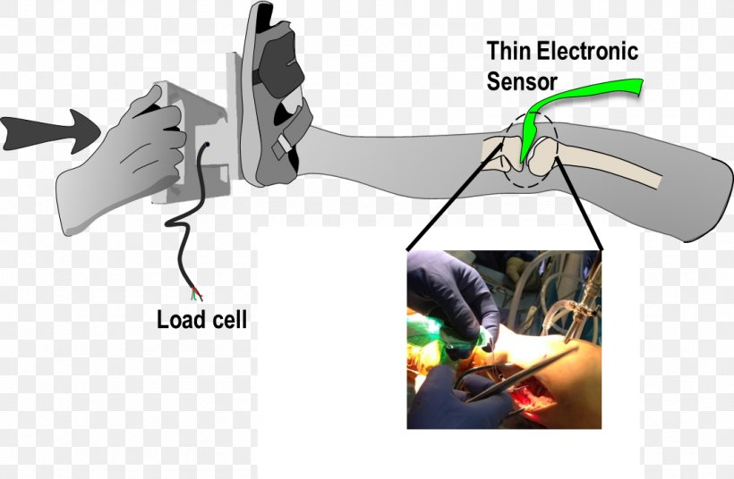 Machine Patient Contact Mechanics Cartilage, PNG, 1077x704px, Machine, Cartilage, Cartoon, Explant Culture, Mechanics Download Free