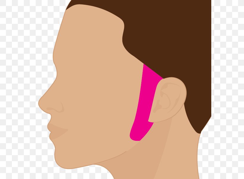 Laser Hair Removal Sideburns Chin Cheek, PNG, 600x600px, Watercolor, Cartoon, Flower, Frame, Heart Download Free