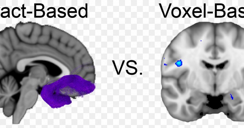 Diffusion MRI Brain Voxel-based Morphometry Magnetic Resonance Imaging White Matter, PNG, 1200x630px, Watercolor, Cartoon, Flower, Frame, Heart Download Free