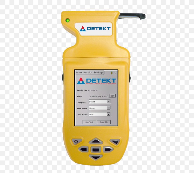 Lateral Flow Test Aflatoxin ELISA Assay Rapid Diagnostic Test, PNG, 476x733px, Lateral Flow Test, Aflatoxin, Assay, Chemistry, Electronics Download Free
