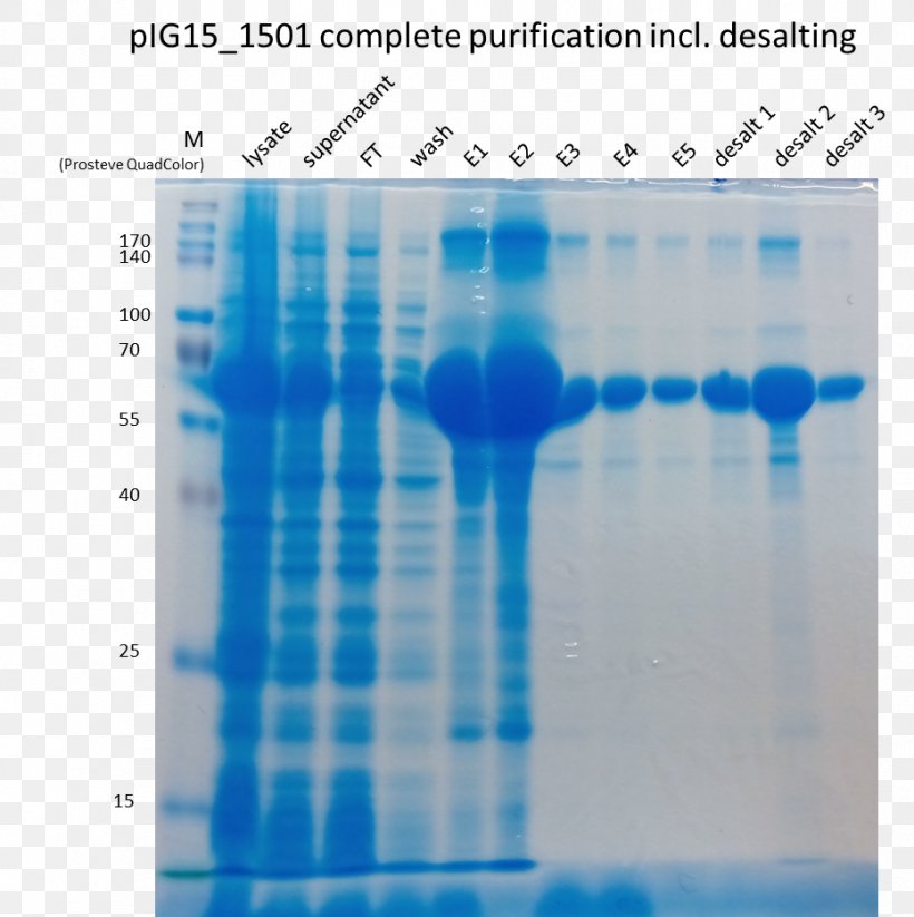 Polyacrylamide Gel Electrophoresis Chromatography Protein SDS-PAGE 岩手県旅館ホテル生活衛生同業組合盛岡支部, PNG, 931x935px, Polyacrylamide Gel Electrophoresis, Blue, Cell, Chromatography, Energy Download Free