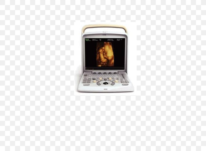 Ultrasonography Portable Ultrasound Doppler Echocardiography Medical Imaging, PNG, 586x600px, Ultrasonography, Audi Q5, Doppler Echocardiography, Doppler Ultrasonography, Electronics Download Free
