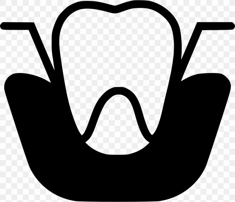 Dentistry Dental Extraction Clip Art, PNG, 980x844px, Dentistry, Artwork, Black, Black And White, Dental Extraction Download Free