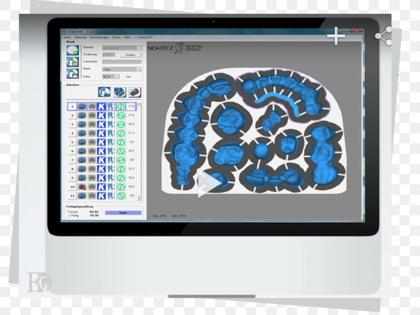 CAD/CAM Dentistry Computer-aided Design Computer-aided Manufacturing Siemens NX Computer-aided Engineering, PNG, 800x615px, Cadcam Dentistry, Brain, Brand, Computer Monitor, Computer Monitors Download Free